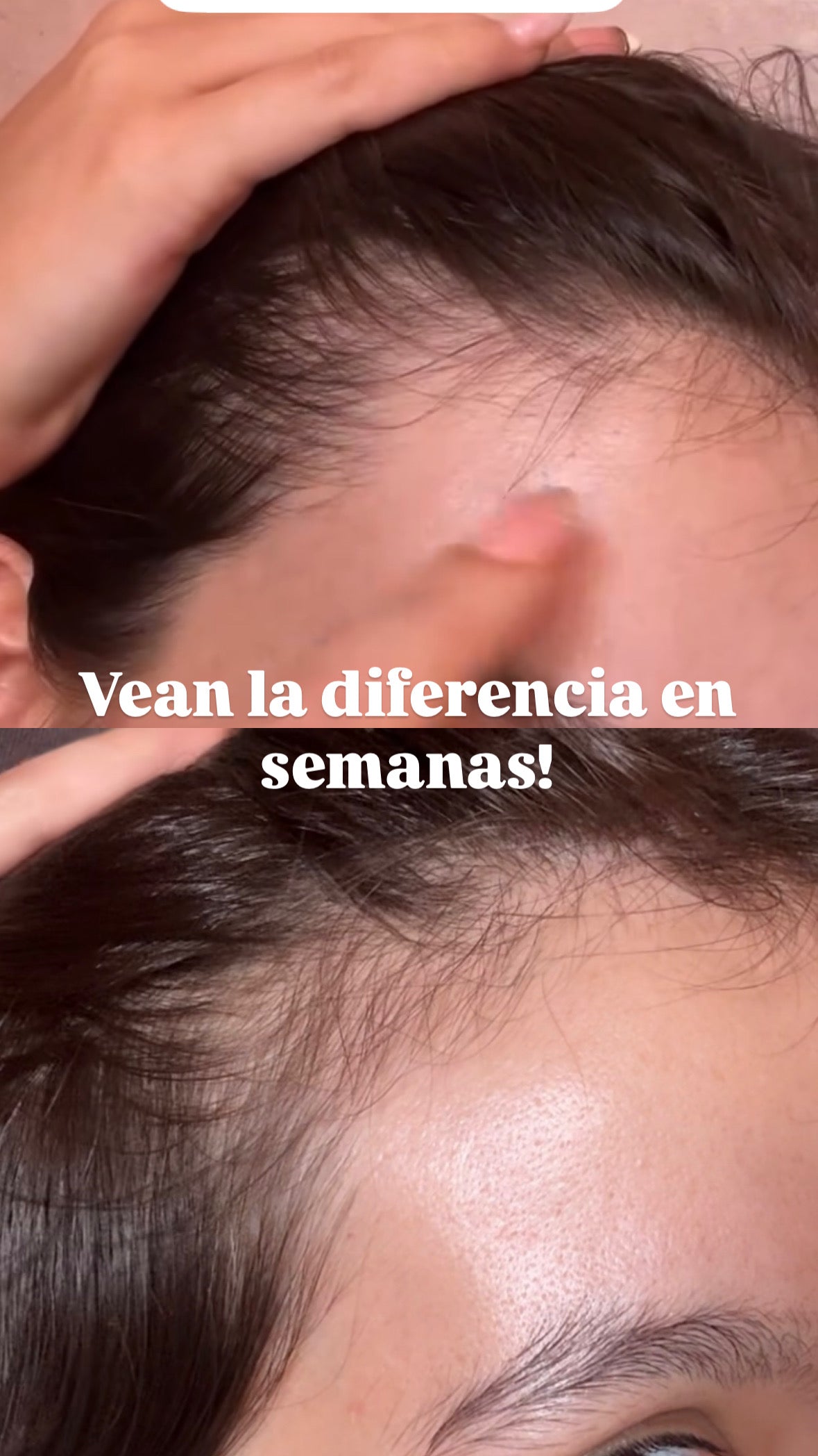 Tonico anticaida (renacer capilar)
